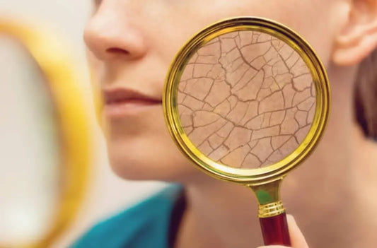 Dry Skin in The Winter  Dry skin is a frequent skin problem, and it is always worse in the winter when the ambient humidity is low (i.e., "winter itch"). It can affect people of various ages and those who have or don't have other skin problems.